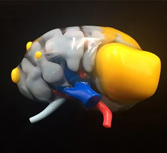 Medical Model Printing